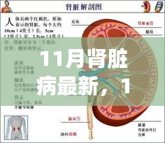 11月肾脏病最新产品全面介绍与评测报告