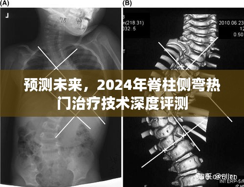 2024年脊柱侧弯热门治疗技术深度预测与评测报告